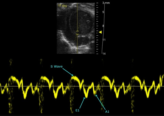 Tissue Doppler Imaging | FUJIFILM VisualSonics